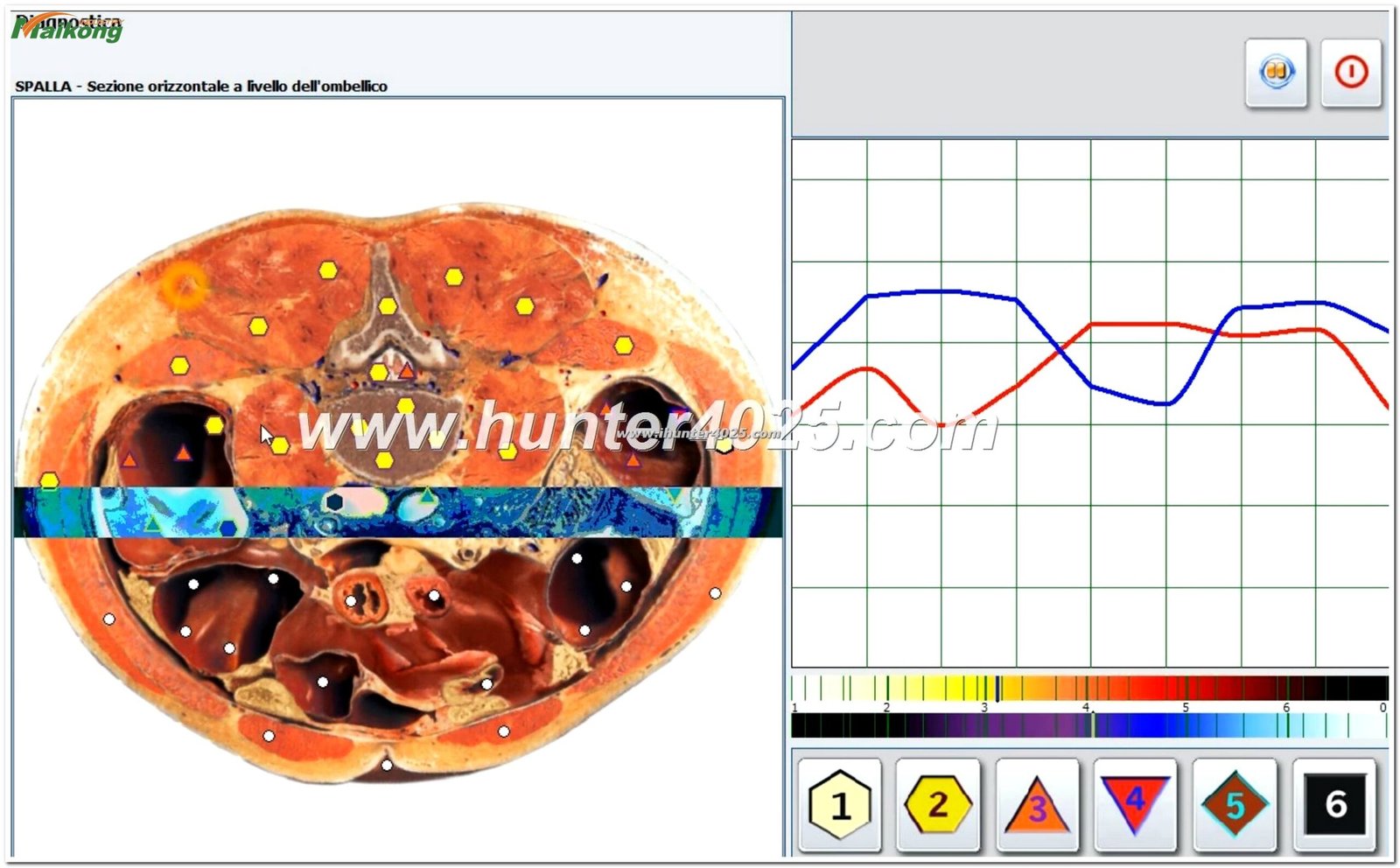 Metatron Hunter 4025