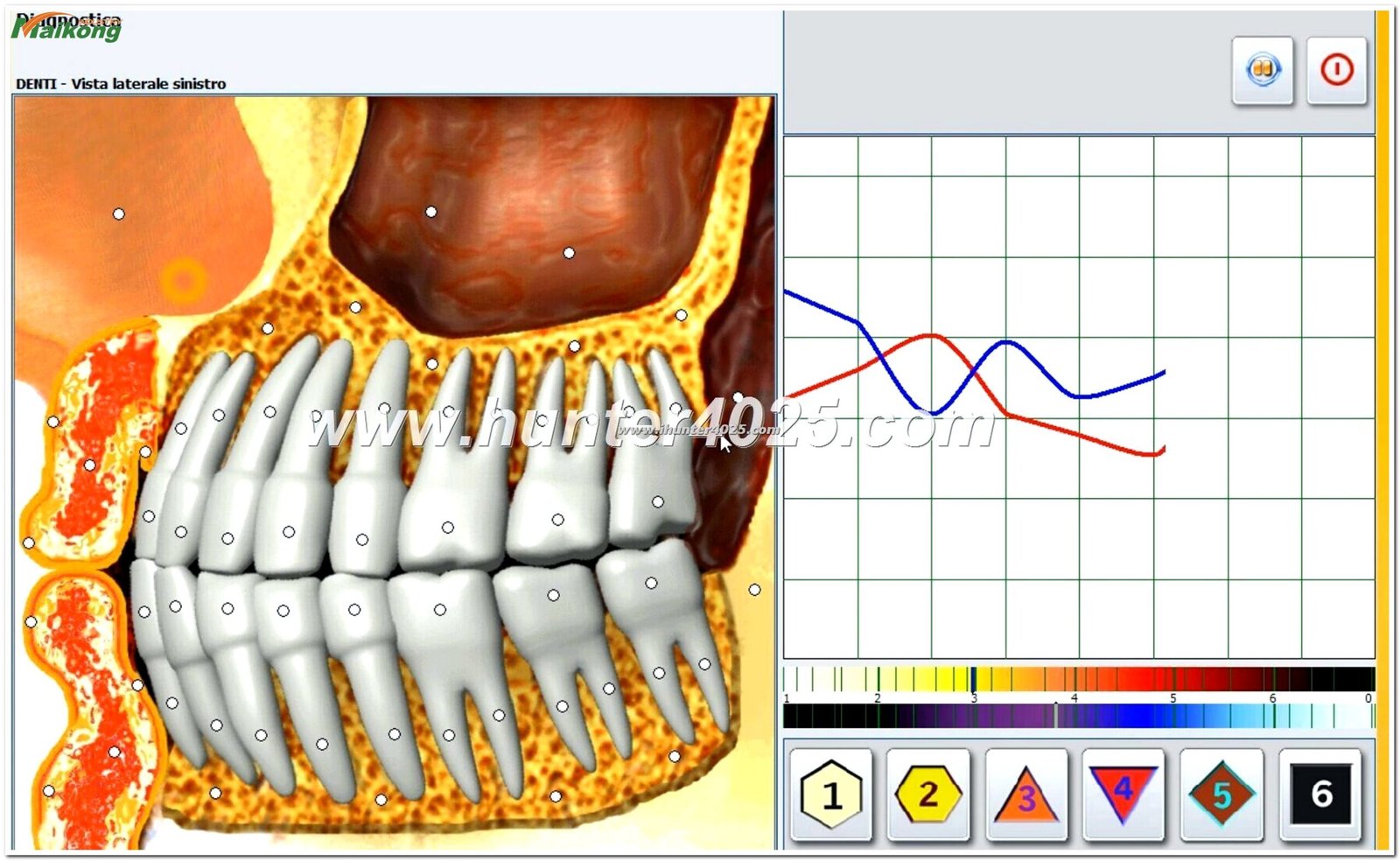 Metatron Hunter 4025 NLS
