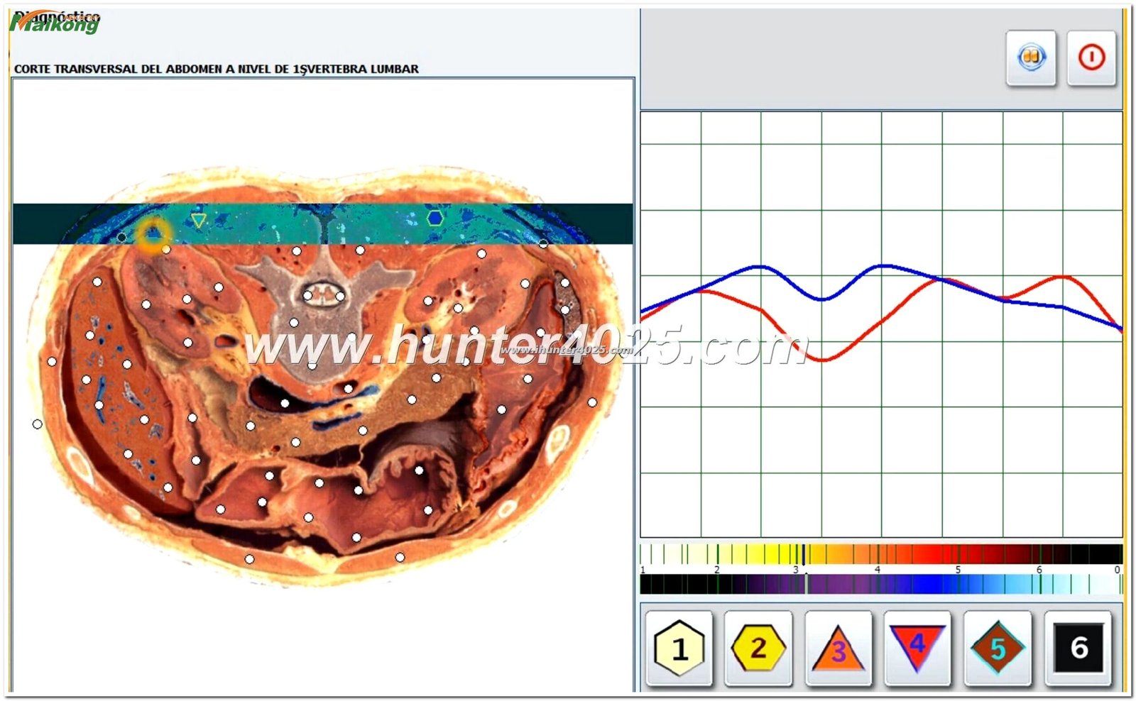 datos en el Metatron Hunter