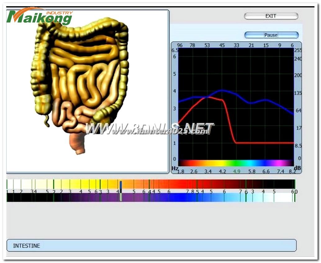 sesión Metatron Hunter 4025 NLS