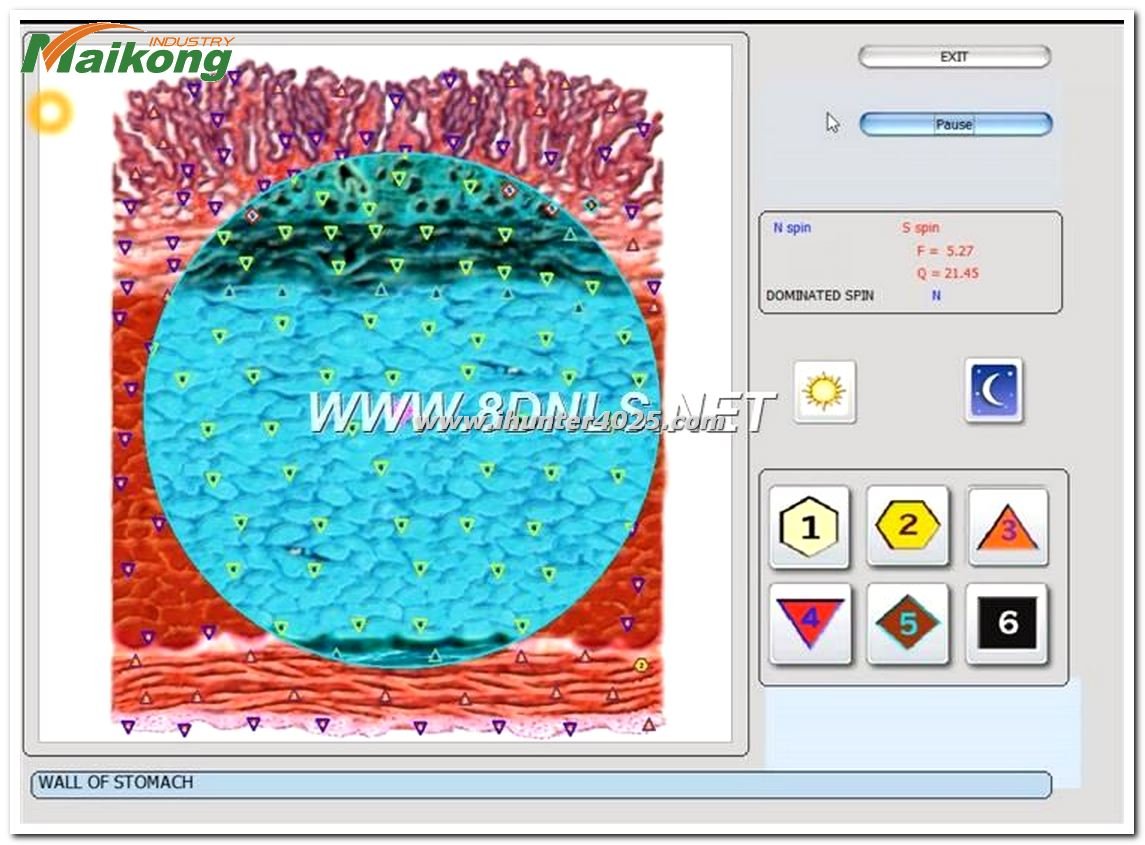 sesión Metatron Hunter 4025 NLS