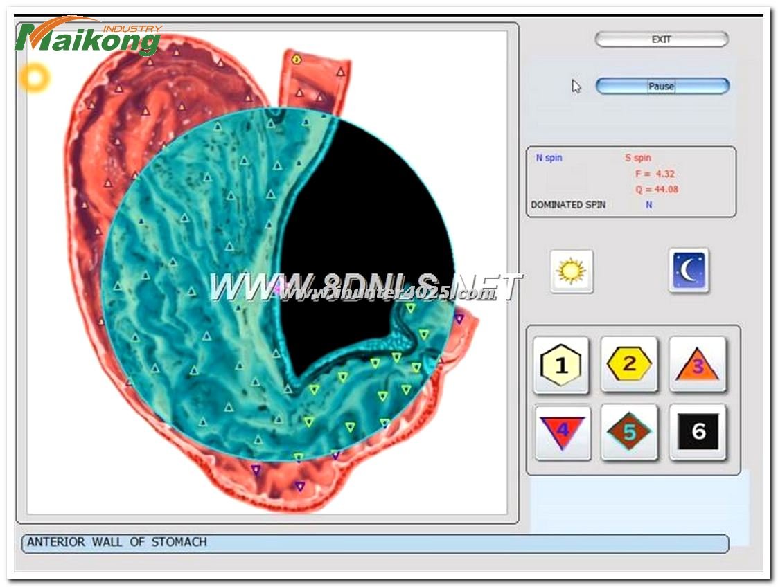 Metatron Hunter 4025 NLS