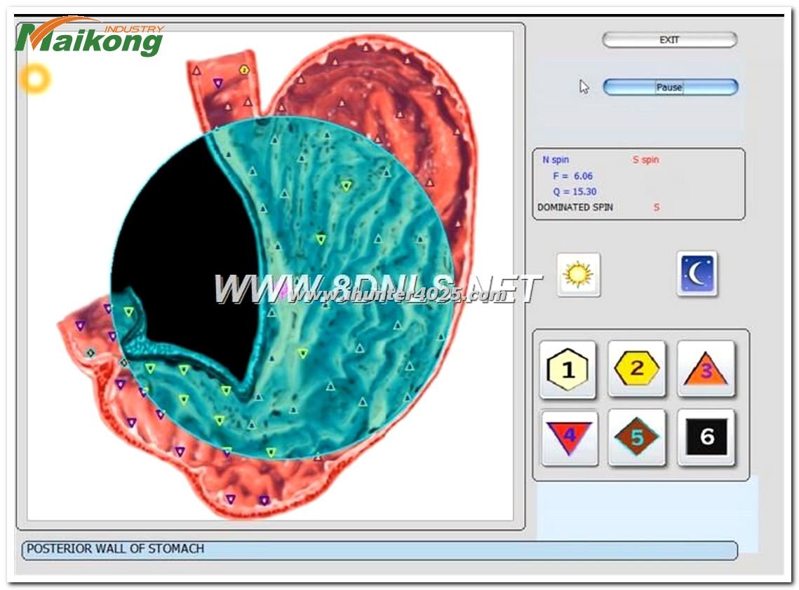 Metatron Hunter 4025 NLS
