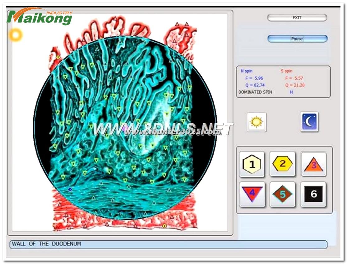 Dispositivo Metatron Hunter 4025 NLS mostrando el modo terapia en pantalla