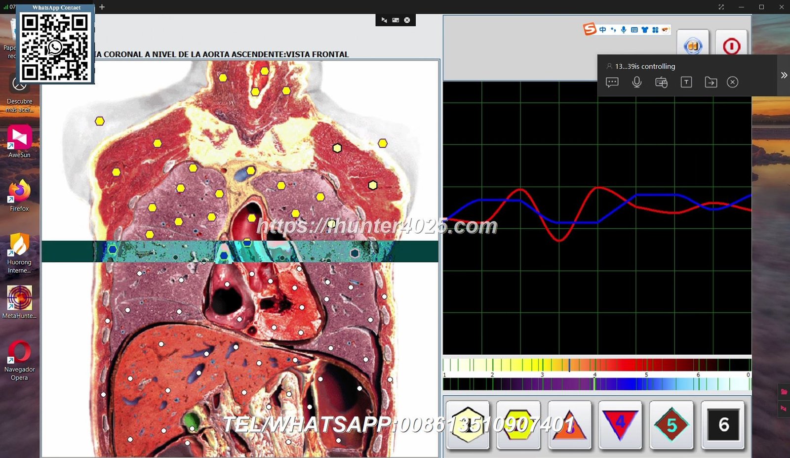 Metatron Hunter 4025 NLS