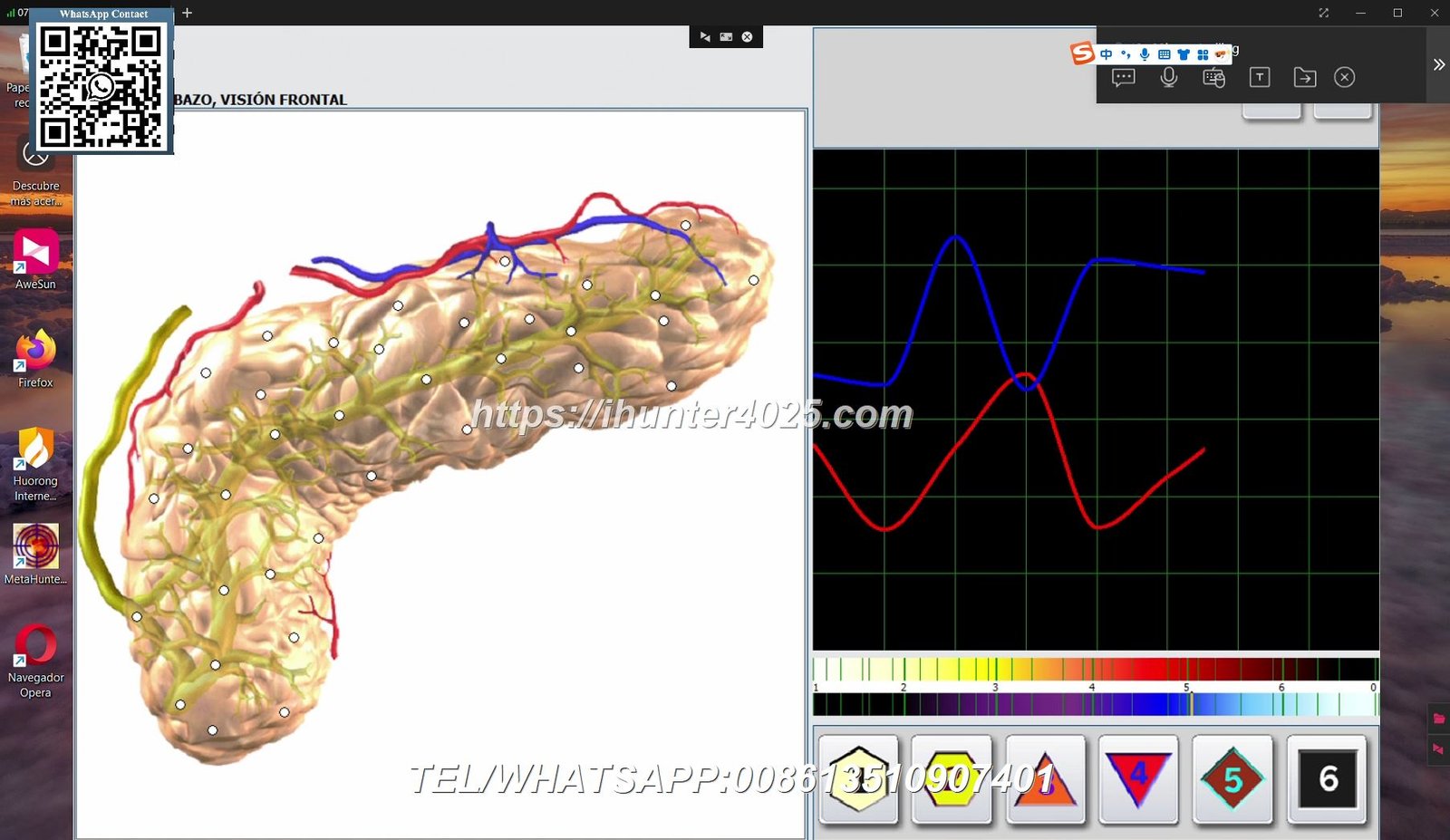 Metatron Hunter 4025 NLS