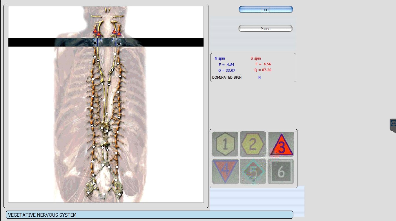 Metatron Hunter 4025 NLS en Estética
