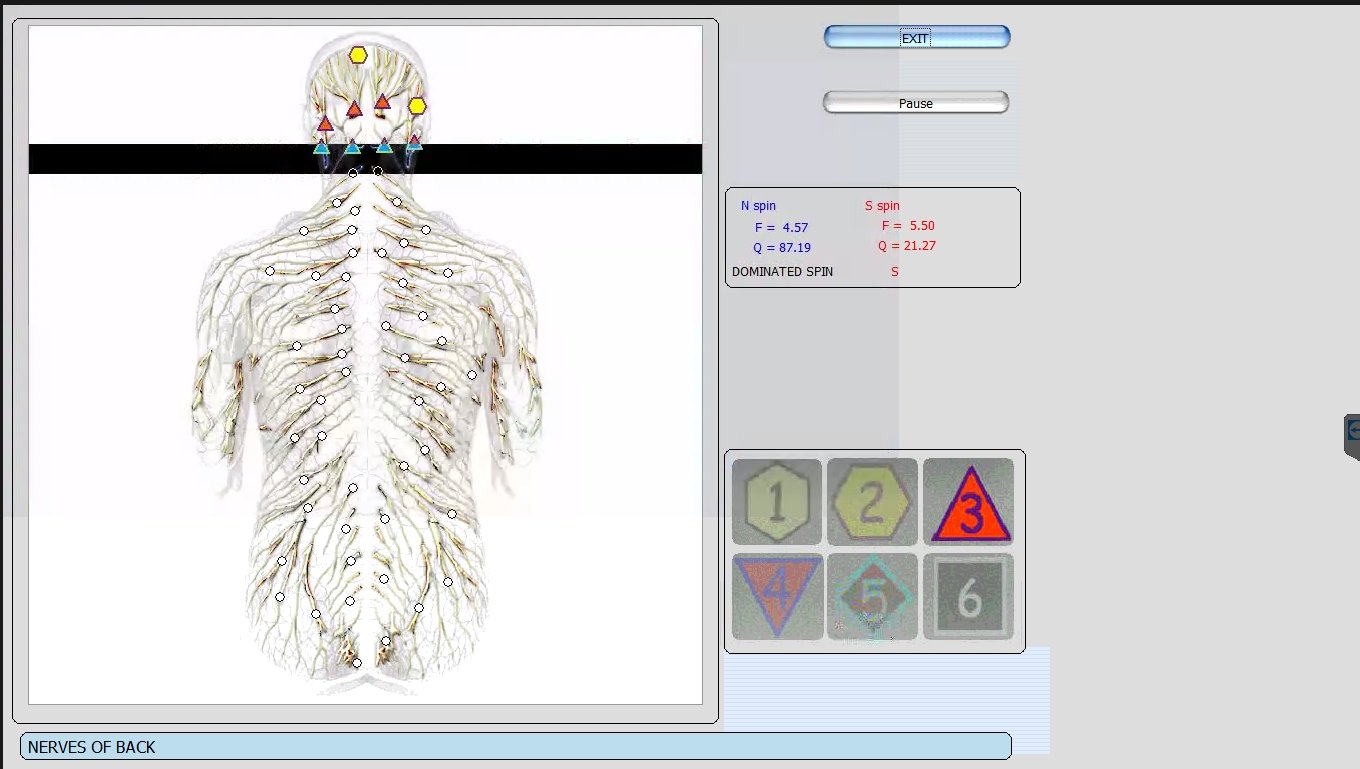 Metatron Hunter 4025 NLS en Estética