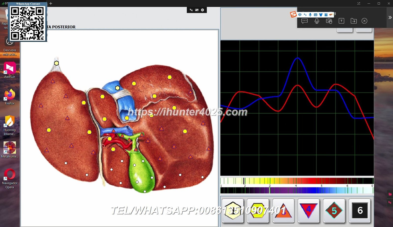 Metatron Hunter 4025 NLS software
