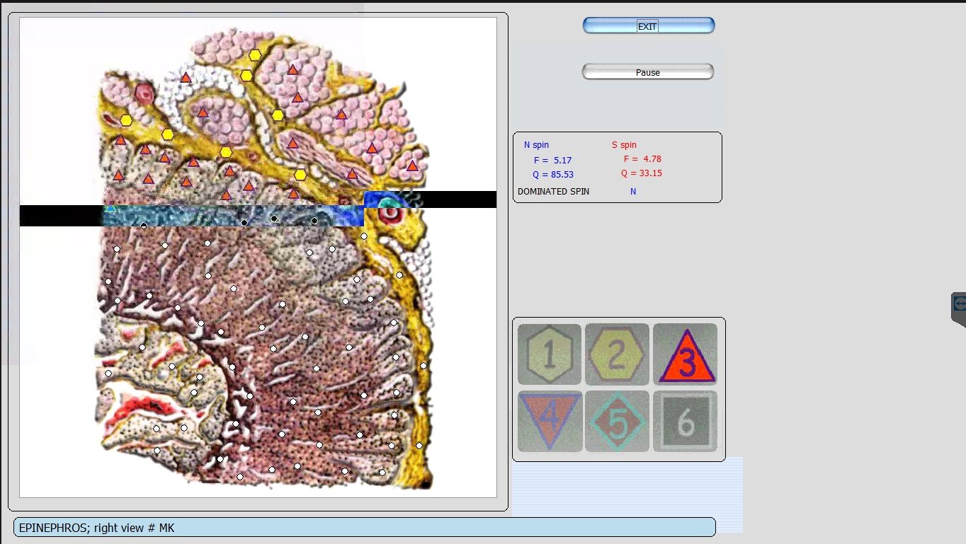 Metatron Hunter 4025 NLS en Estética
