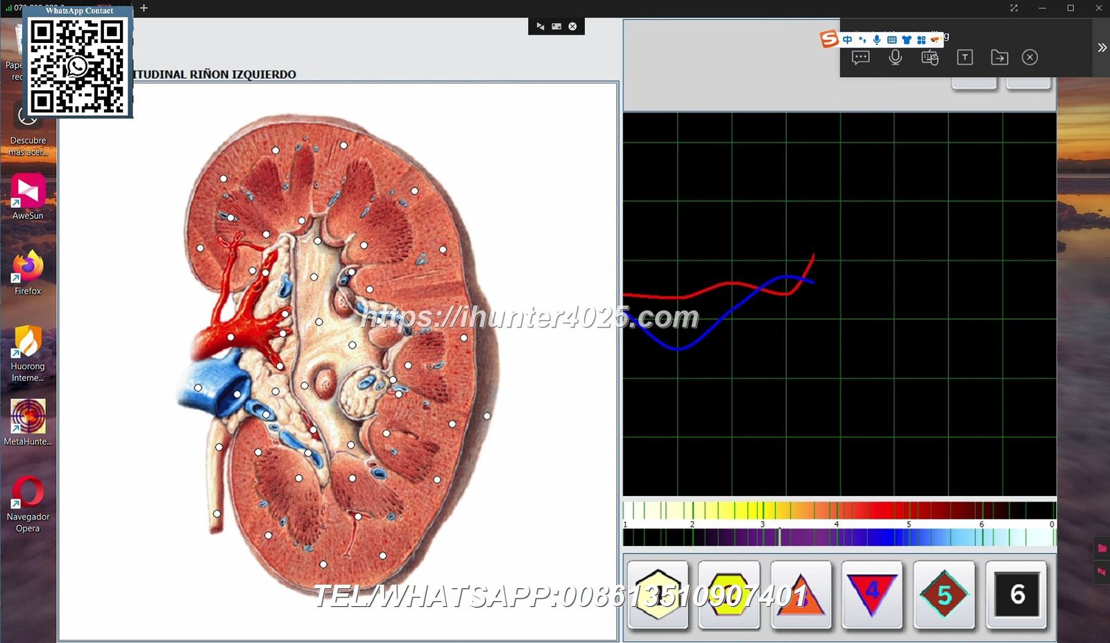 Metatron Hunter 4025