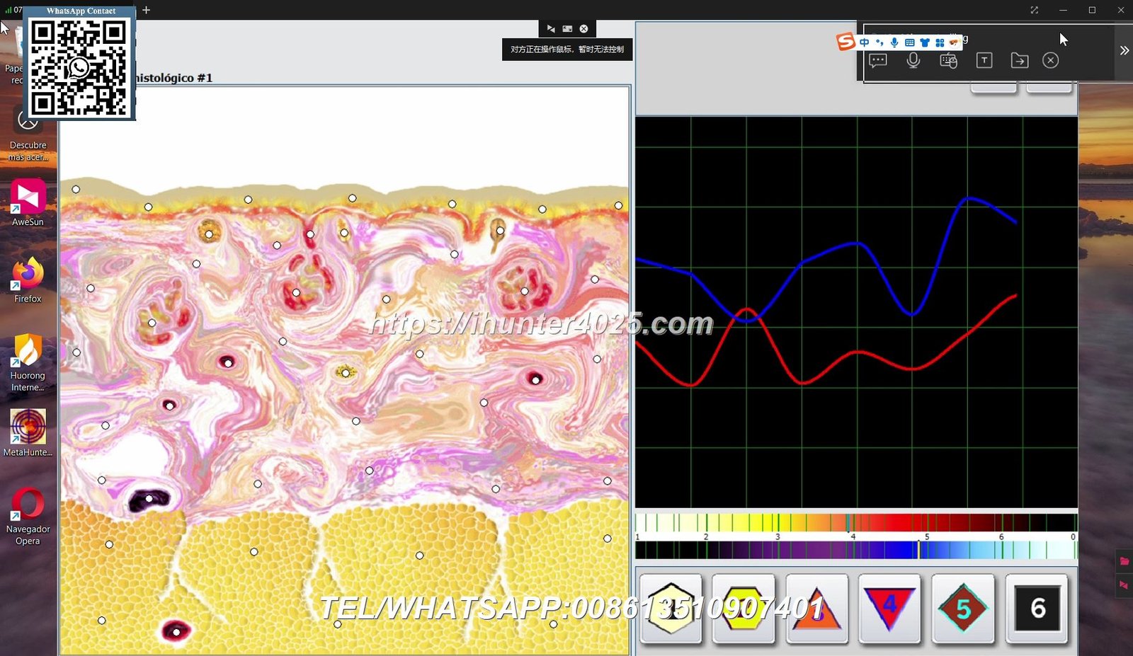 datos en el Metatron Hunter