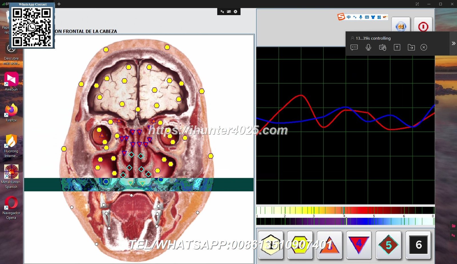 Metatron Hunter 4025 NLS