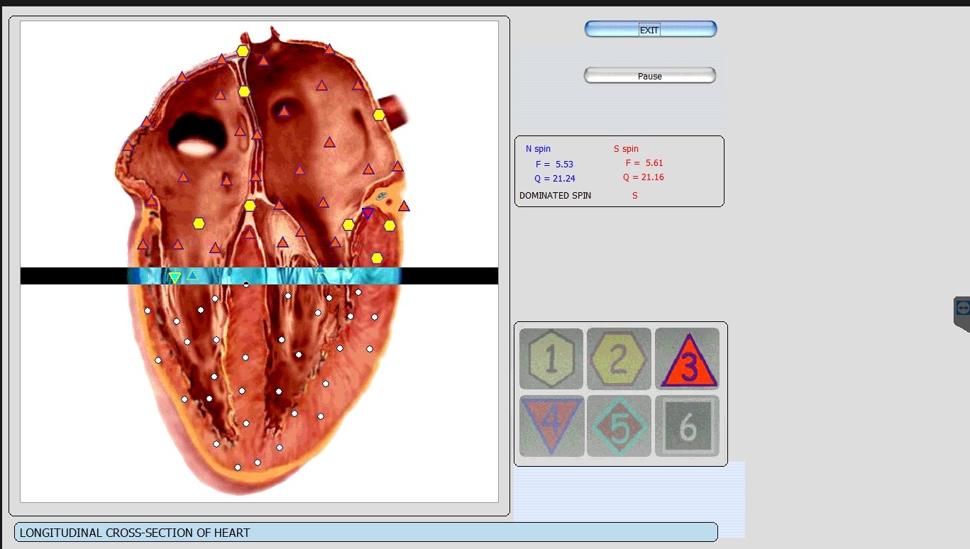 Metatron Hunter 4025 NLS