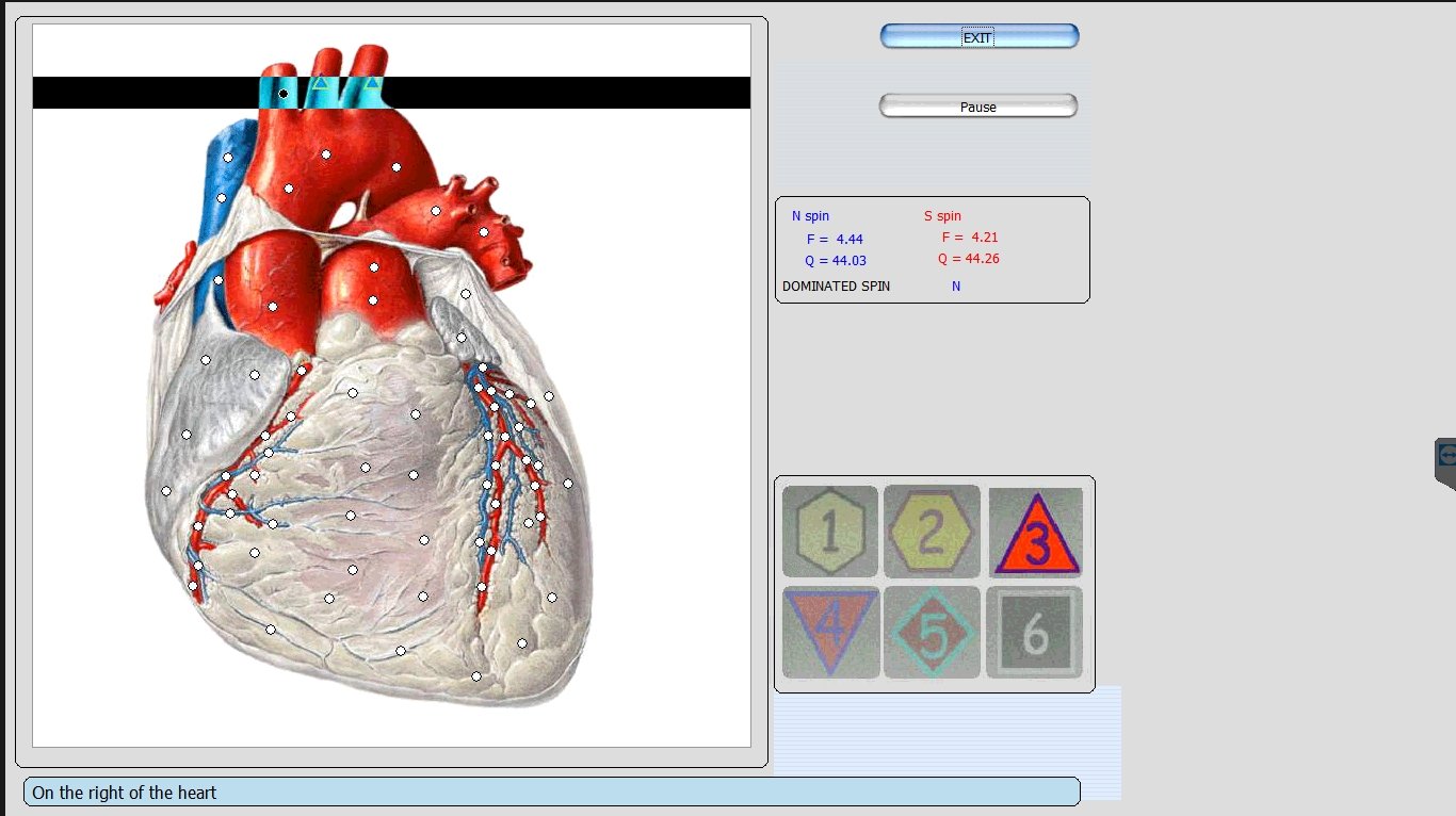 Metatron Hunter 4025 NLS