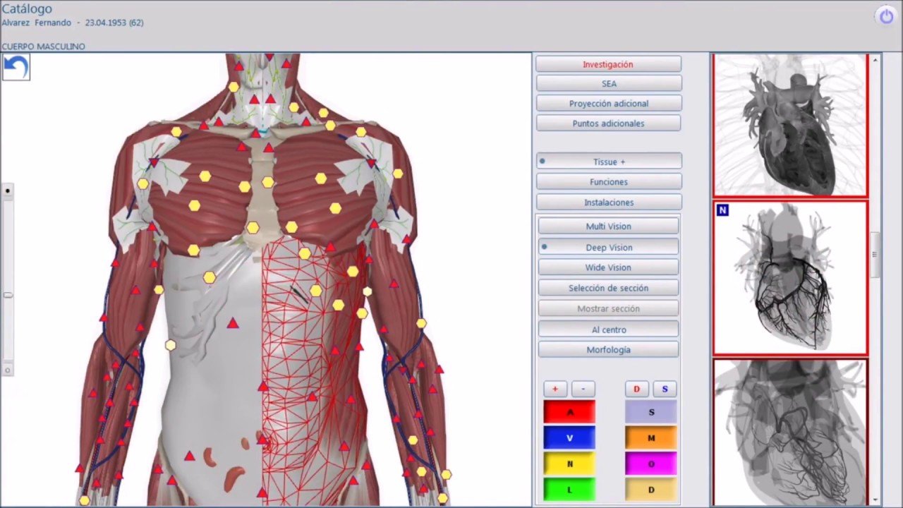 Metatron Hunter 4025 NLS