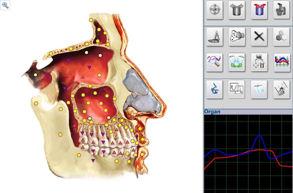 Metatron Hunter 4025 NLS