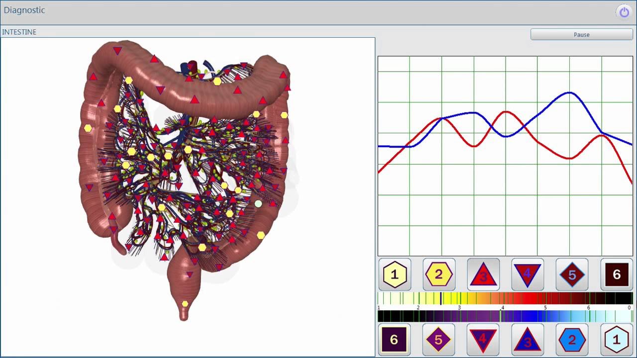 Metatron Hunter 4025 NLS