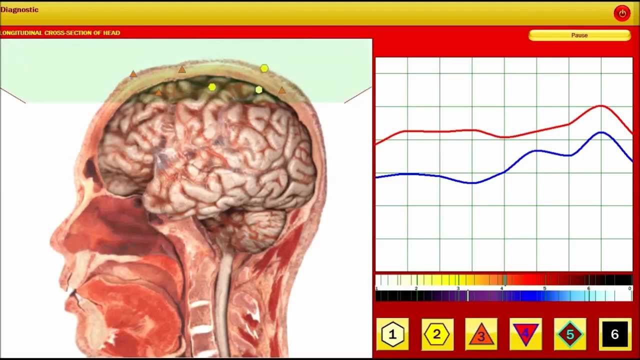 Metatron Hunter 4025 NLS red dragon 8