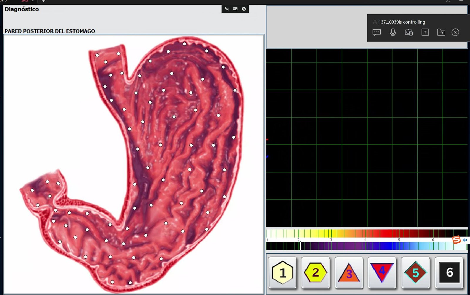 Metatron Hunter 4025 NLS