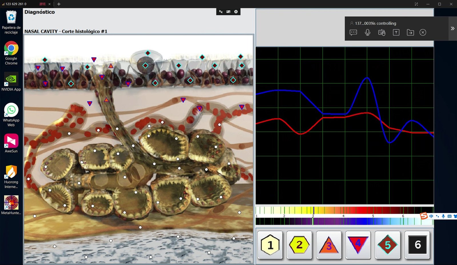 Metatron Hunter 4025 NLS