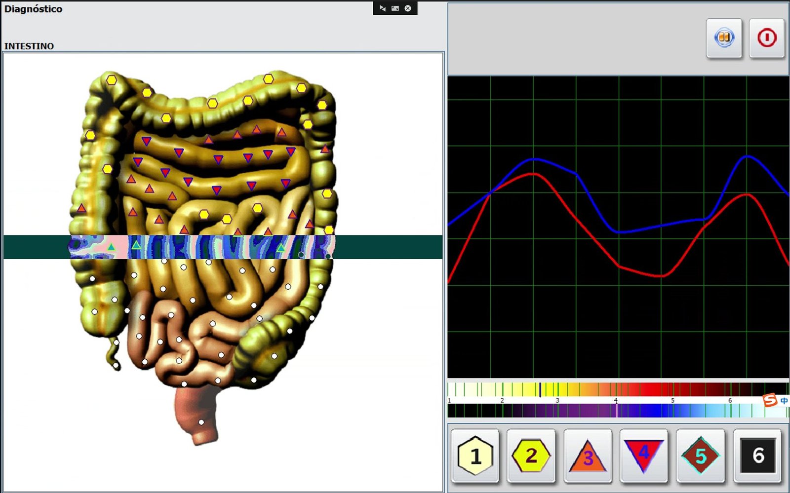 Metatron Hunter 4025 NLS