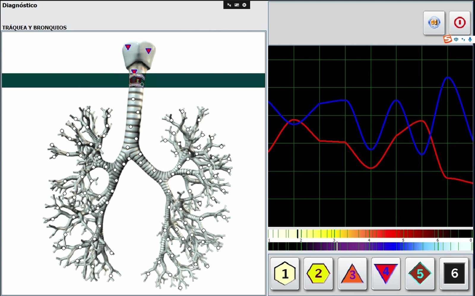 Metatron Hunter 4025 NLS