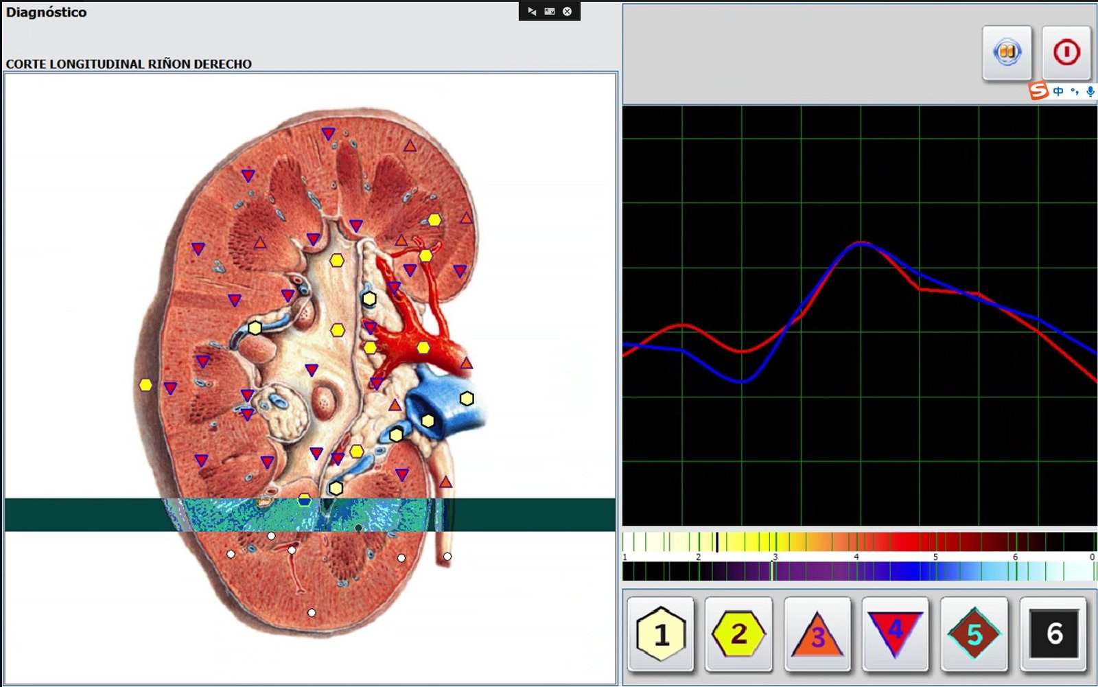 Metatron Hunter 4025 NLS SOFTWARE