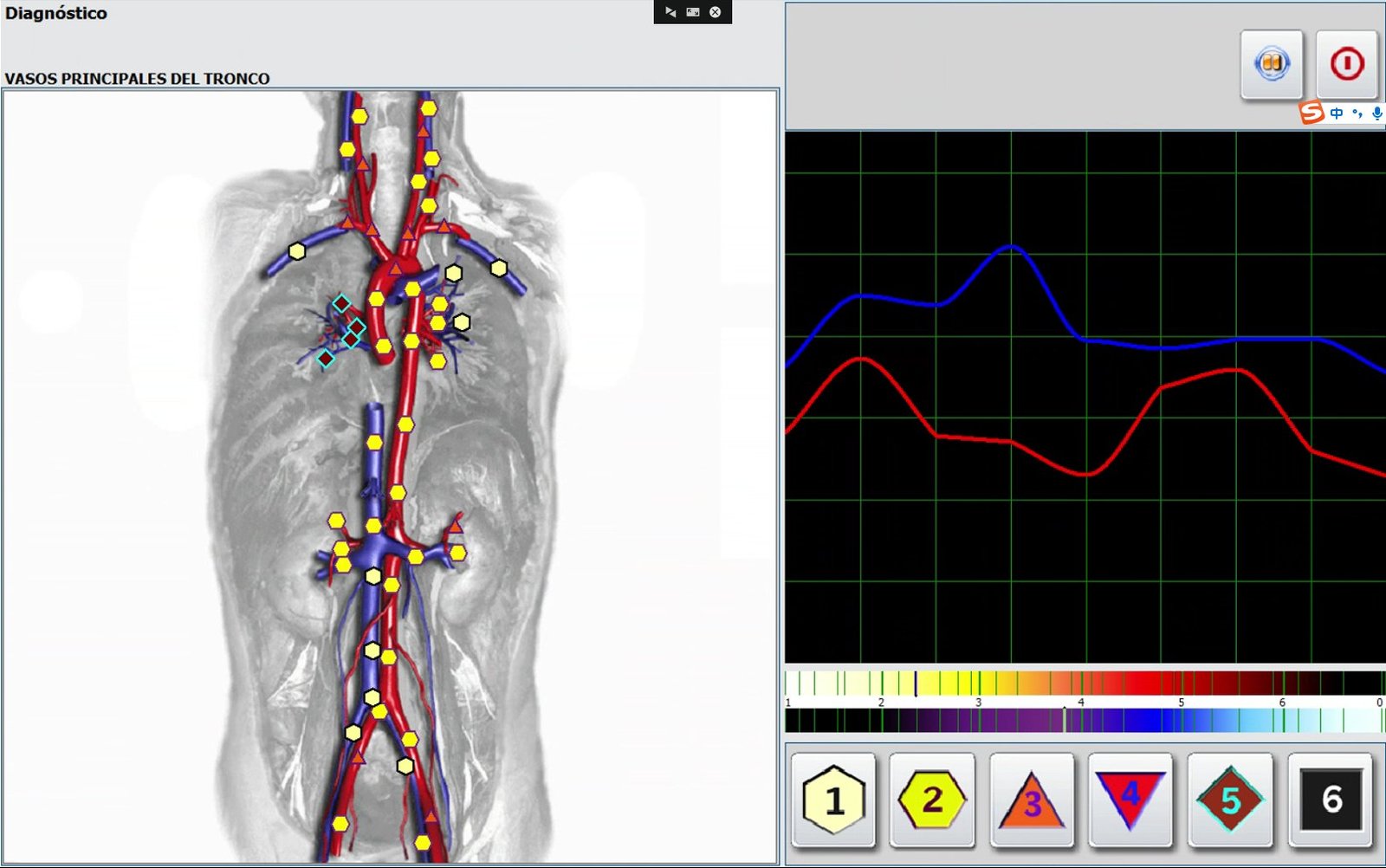 Metatron Hunter 4025 NLS