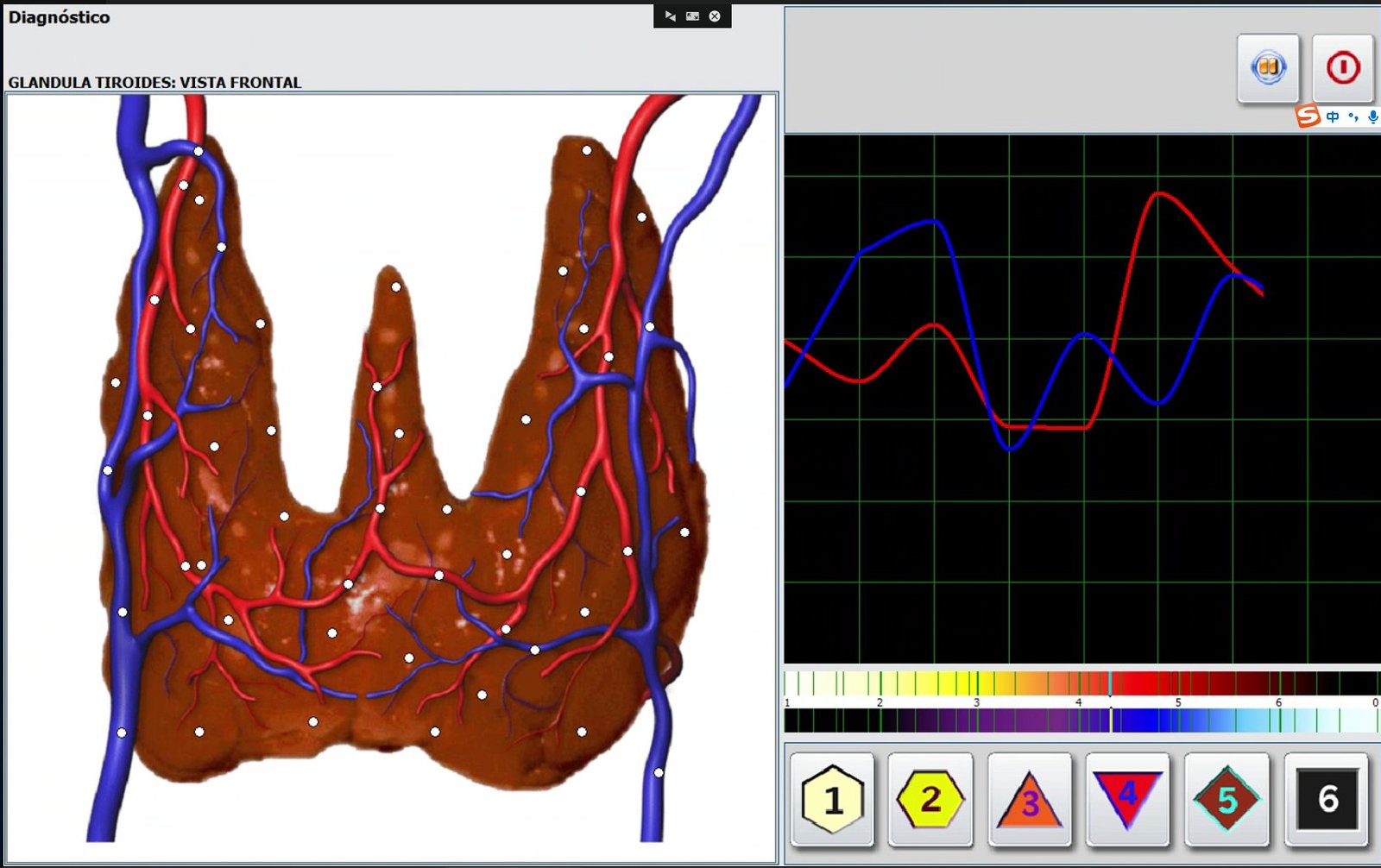 Metatron Hunter 4025 NLS sistema de diagnóstico no invasivo