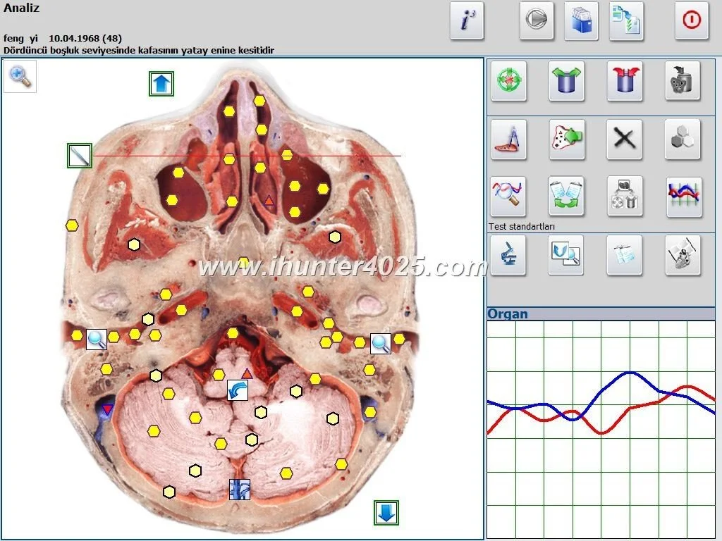 Cómo integrar NLS biofeedback (Metatron Hunter) en sesiones de fisioterapia para seguimiento y optimización de la rehabilitación — MAIKONG Hunter 4025 Metatron (3884).JPG