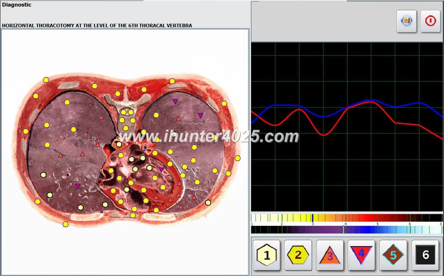 Biophilia Intruder NLS: ¿qué significa “escaneo más rápido” para profesionales de terapias complementarias en Argentina? — MAIKONG Hunter 4025 Metatron (4964).JPG