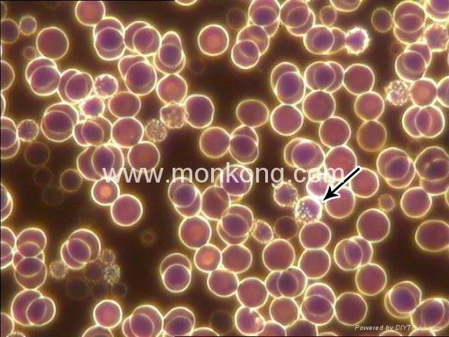 Paquete completo llave en mano de Live Blood Analysis — respuesta directa para consultorios privados — bright field and dark field microscopy ppt (4).jpg