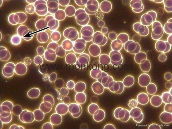 Paquete completo llave en mano de Live Blood Analysis — respuesta directa para consultorios privados — bright field and dark field microscopy ppt (5).jpg