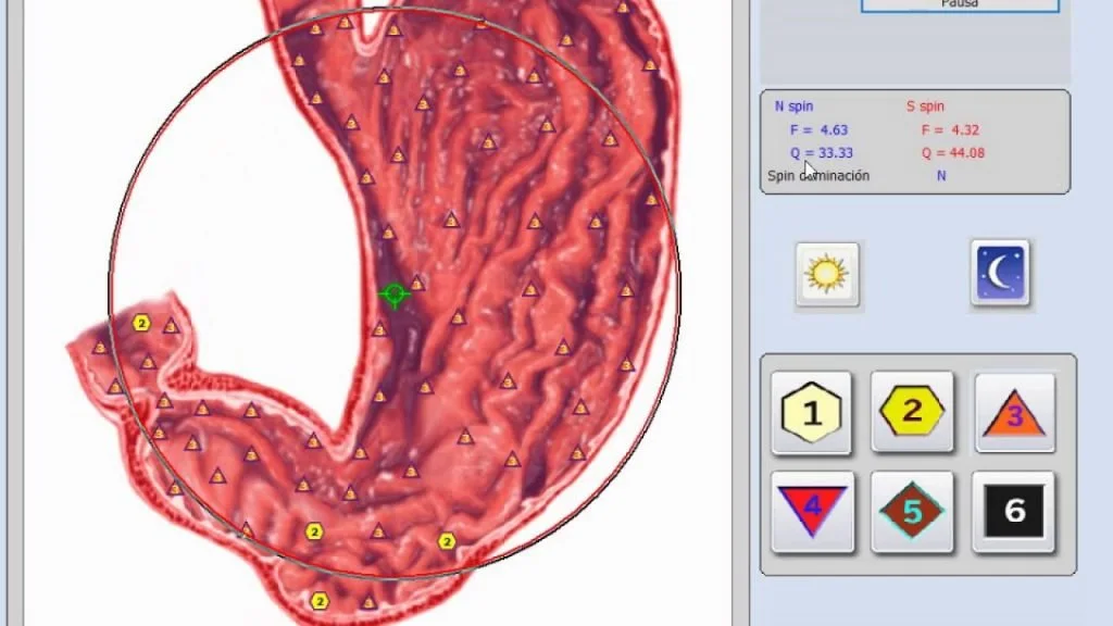 New Prostate therapy machine — MAIKONG Hunter 4025 Metatron (4520).jpg